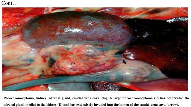 pheochromocytoma in dogs pathology of adrenal gland ppt pheochromocytoma in dogs pathology of adrenal gland ppt