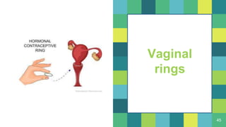 45
Vaginal
rings
 