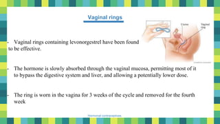 46
Hormonal contraceptives
- Vaginal rings containing levonorgestrel have been found
to be effective.
- The hormone is slowly absorbed through the vaginal mucosa, permitting most of it
to bypass the digestive system and liver, and allowing a potentially lower dose.
- The ring is worn in the vagina for 3 weeks of the cycle and removed for the fourth
week
Vaginal rings
 