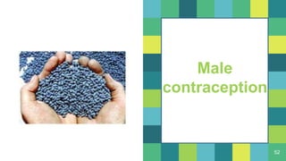 52
Male
contraception
 