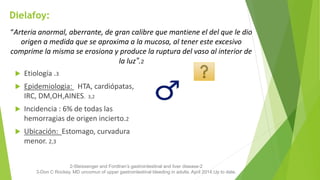 Dielafoy:
2-Sleissenger and Fordtran’s gastrointestinal and liver disease-2
3-Don C Rockey. MD uncomun of upper gastrointestinal bleeding in adults. April 2014.Up to date.
“Arteria anormal, aberrante, de gran calibre que mantiene el del que le dio
origen a medida que se aproxima a la mucosa, al tener este excesivo
comprime la misma se erosiona y produce la ruptura del vaso al interior de
la luz”.2
 Etiología .3
 Epidemiologia: HTA, cardiópatas,
IRC, DM,OH,AINES. 3,2
 Incidencia : 6% de todas las
hemorragias de origen incierto.2
 Ubicación: Estomago, curvadura
menor. 2,3
 