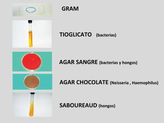 GRAM
TIOGLICATO (bacterias)
AGAR SANGRE (bacterias y hongos)
AGAR CHOCOLATE (Neisseria , Haemophilus)
SABOUREAUD (hongos)
 