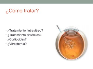 ¿Cómo tratar?
• ¿Tratamiento intravítreo?
• ¿Tratamiento sistémico?
• ¿Corticoides?
• ¿Vitrectomía?
 
