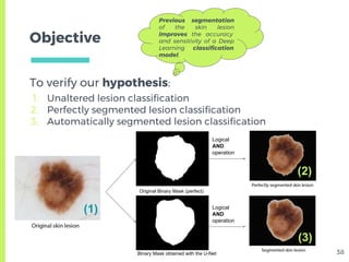 Skin Lesion Detection from Dermoscopic Images using Convolutional ...