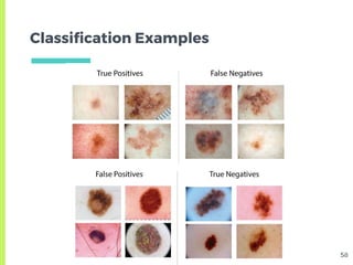 Skin Lesion Detection from Dermoscopic Images using Convolutional ...