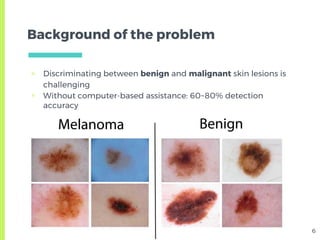Skin Lesion Detection from Dermoscopic Images using Convolutional ...