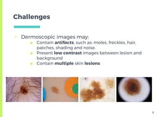 Skin Lesion Detection from Dermoscopic Images using Convolutional ...