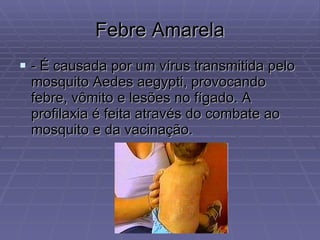Febre Amarela - É causada por um vírus transmitida pelo mosquito Aedes aegypti, provocando febre, vômito e lesões no fígado. A profilaxia é feita através do combate ao mosquito e da vacinação.  