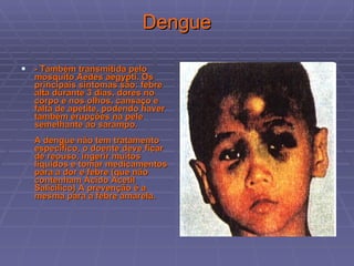 Dengue - Também transmitida pelo mosquito Aedes aegypti. Os principais sintomas são: febre alta durante 3 dias, dores no corpo e nos olhos, cansaço e falta de apetite, podendo haver também erupções na pele semelhante ao sarampo.  A dengue não tem tratamento específico, o doente deve ficar de reouso, ingerir muitos líquidos e tomar medicamentos para a dor e febre (que não contenham Ácido Acetil Salicílico) A prevenção é a mesma para a febre amarela.  