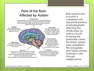 Brain dysfunction
                                   in autism is
                                   correlated with
                                   abnormal patterns
                                   of development
                                   affecting the
                                   whole brain as
                                   well as circuits
                                   involving the
                                   prefrontal cortex,
                                   the limbic system,
                                   and cerebellum.
                                   The amygdala
                                   and hippocampus
                                   increase in size
                                   through
                                   adolescence.

Picture Source: (Health on Care)   Source: Predescu et. al. 2010)
 