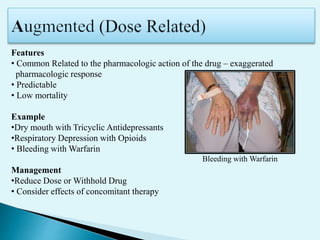 Features
• Common Related to the pharmacologic action of the drug – exaggerated
pharmacologic response
• Predictable
• Low mortality
Example
•Dry mouth with Tricyclic Antidepressants
•Respiratory Depression with Opioids
• Bleeding with Warfarin
Management
•Reduce Dose or Withhold Drug
• Consider effects of concomitant therapy
Bleeding with Warfarin
 