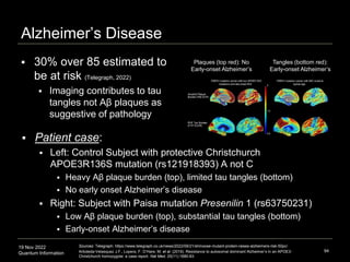 19 Nov 2022
Quantum Information
Alzheimer’s Disease
94
Sources: Telegraph: https://www.telegraph.co.uk/news/2022/09/21/shm...