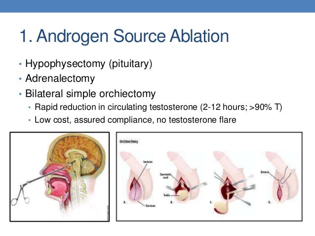 Prostate Cancer Review Nature Prostate Cancer Review Nature