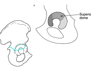 Tabular Rings adult-acetabular-fracture pelvic ring fracture | PPT