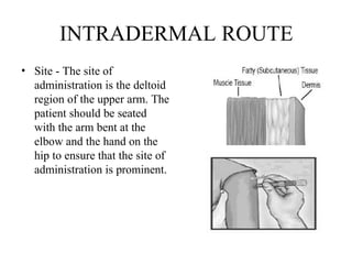 INTRADERMAL ROUTE
• Site - The site of
administration is the deltoid
region of the upper arm. The
patient should be seated
with the arm bent at the
elbow and the hand on the
hip to ensure that the site of
administration is prominent.
 