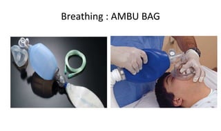 Breathing : AMBU BAG
 