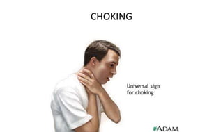 CHOKING
 