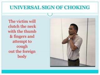 The victim will
clutch the neck
with the thumb
& fingers and
attempt to
cough
out the foreign
body
UNIVERSAL SIGN OF CHOKING
 
