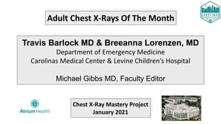 Adult Chest X-Rays Of The Month
Travis Barlock MD & Breeanna Lorenzen, MD
Department of Emergency Medicine
Carolinas Medical Center & Levine Children’s Hospital
Michael Gibbs MD, Faculty Editor
Chest X-Ray Mastery Project
January 2021
 