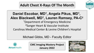 Adult Chest X-Rays Of The Month
Daniel Escobar, MD1, Angela Pikus, MD1,
Alex Blackwell, MD1, Lauren Ramsey, PA-C2
1Department of Emergency Medicine
2Sanger Heart & Vascular Institute
Carolinas Medical Center & Levine Children’s Hospital
Michael Gibbs, MD - Faculty Editor
CMC Imaging Mastery Project
January 2022
 