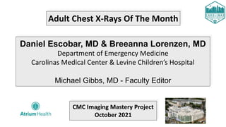 Adult Chest X-Rays Of The Month
Daniel Escobar, MD & Breeanna Lorenzen, MD
Department of Emergency Medicine
Carolinas Medical Center & Levine Children’s Hospital
Michael Gibbs, MD - Faculty Editor
CMC Imaging Mastery Project
October 2021
 