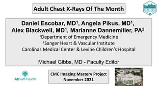 Adult Chest X-Rays Of The Month
Daniel Escobar, MD1, Angela Pikus, MD1,
Alex Blackwell, MD1, Marianne Dannemiller, PA2
1Department of Emergency Medicine
2Sanger Heart & Vascular Institute
Carolinas Medical Center & Levine Children’s Hospital
Michael Gibbs, MD - Faculty Editor
CMC Imaging Mastery Project
November 2021
 