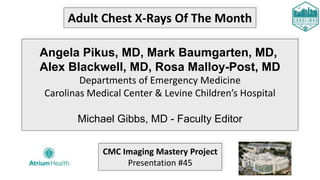 Adult Chest X-Rays Of The Month
Angela Pikus, MD, Mark Baumgarten, MD,
Alex Blackwell, MD, Rosa Malloy-Post, MD
Departments of Emergency Medicine
Carolinas Medical Center & Levine Children’s Hospital
Michael Gibbs, MD - Faculty Editor
CMC Imaging Mastery Project
Presentation #45
 