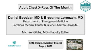 Adult Chest X-Rays Of The Month
Daniel Escobar, MD & Breeanna Lorenzen, MD
Department of Emergency Medicine
Carolinas Medical Center & Levine Children’s Hospital
Michael Gibbs, MD - Faculty Editor
CMC Imaging Mastery Project
August 2021
 