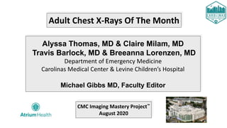 Adult Chest X-Rays Of The Month
Alyssa Thomas, MD & Claire Milam, MD
Travis Barlock, MD & Breeanna Lorenzen, MD
Department of Emergency Medicine
Carolinas Medical Center & Levine Children’s Hospital
Michael Gibbs MD, Faculty Editor
CMC Imaging Mastery Project™
August 2020
 