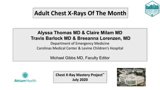 Adult Chest X-Rays Of The Month
Alyssa Thomas MD & Claire Milam MD
Travis Barlock MD & Breeanna Lorenzen, MD
Department of Emergency Medicine
Carolinas Medical Center & Levine Children’s Hospital
Michael Gibbs MD, Faculty Editor
Chest X-Ray Mastery Project™
July 2020
 