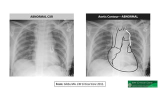 From: Gibbs MA. EM Critical Care 2011.
 