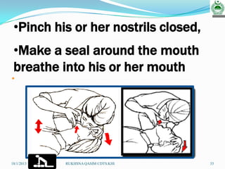 RUKHSANA QASIM CDTS.KHI.
•Pinch his or her nostrils closed,
•Make a seal around the mouth
breathe into his or her mouth
•
33RUKHSNA QASIM CDTS.KHI18/1/2013
 