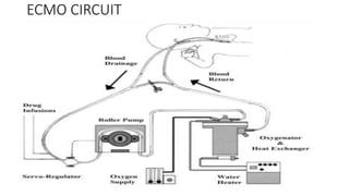 ECMO CIRCUIT
 