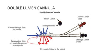 DOUBLE LUMEN CANNULA
 