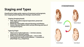 Comprehensive Adult Health Nursing: Urethral Strictures, Hydronephrosis ...