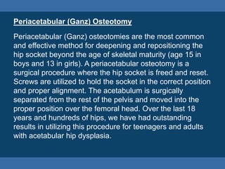 Periacetabular (Ganz) Osteotomy
Periacetabular (Ganz) osteotomies are the most common
and effective method for deepening a...