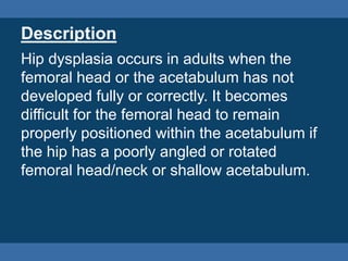 https://image.slidesharecdn.com/adulthipdysplasiapresentation-140626080756-phpapp02/85/adult-hip-dysplasia-presentation-3-320.jpg?cb=1665713703