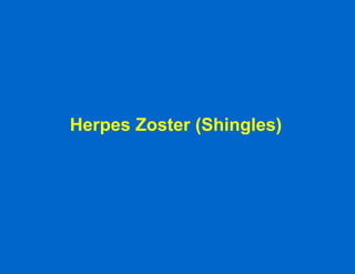 Herpes Zoster (Shingles) 