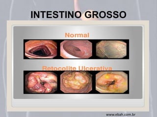 INTESTINO GROSSO 
www.ebah.com.br 
 