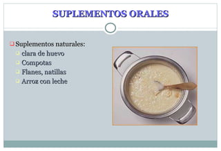 SUPLEMENTOS ORALES Suplementos naturales: clara de huevo Compotas Flanes , natillas Arroz con leche 