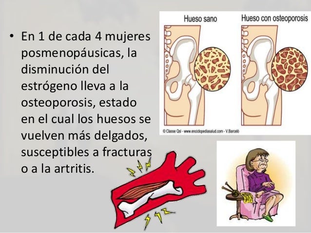 Bady los estimuladores de la potencia
