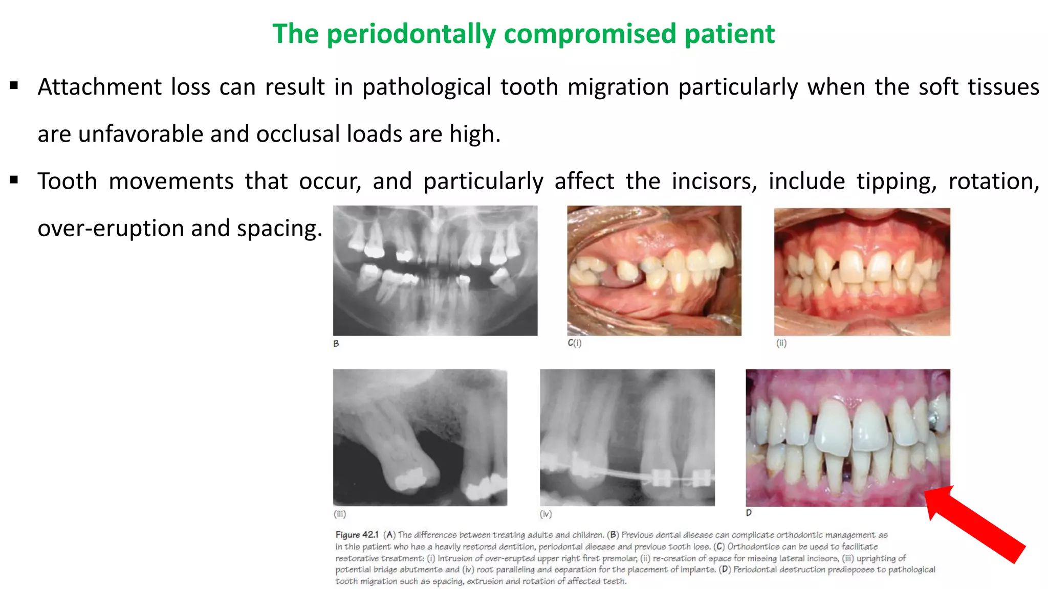 Adult orthodontics.pdf