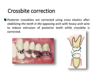 Adult Orthodontics.pptx