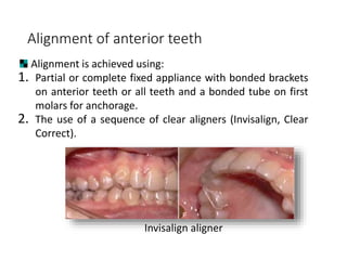 Adult Orthodontics.pptx