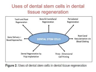 Uses of dental stem cells in dental
tissue regeneration
50
 