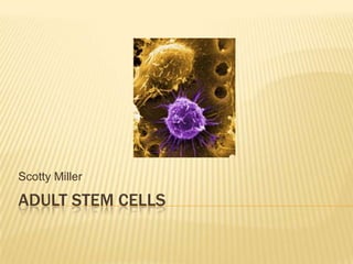 Scotty Miller

ADULT STEM CELLS
 
