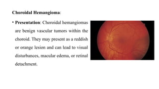 ADULT TUMORS in the eye and orbit of different condtions | PPTX