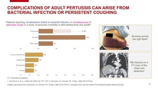 COMPLICATIONS OF ADULT PERTUSSIS CAN ARISE FROM
BACTERIAL INFECTION OR PERSISTENT COUGHING
Urinary incontinence
Weight loss
Rib fractures
Fainting
-1% 1% 3% 5% 7% 9% 11% 13% 15%
4%
3%
2%
2%
CT, computed tomography
25
1. De Serres G et al. J Infect Dis 2000;182:174–179; 2. Zambrano JA, Herman TN. N Eng J Med 2018;378:e4
Images reproduced from Zambrano JA, Herman TN. N Eng J Med 2018;378:e4. Copyright 2018, with permission from Massachusetts Medical Society.
Pneumonia
Sinusitis
Otitis media
-5% 0% 5% 10% 15%
4–9%
13%
4%
Rib fracture on a
CT scan of the
chest and
abdomen2
Bruising across
the right flank2
Patients reporting complications linked to bacterial infection or consequences of
pertussis cough in a study of pertussis morbidity in 664 adolescents and adults1
 