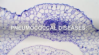 PNEUMOCOCCAL DISEASES:
Confidential. For internal use only. 27
 