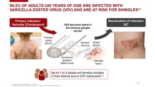 HZ, herpes zoster; VZV, varicella zoster virus * US Data
1. Kimberlin DW et al. New Engl J Med 2007;356:1338 1343; 2. Harpaz R
‒ et al. MMWR Recomm Rep 2008;57:1 30
‒
41
Primary infection:
Varicella (Chickenpox)1
VZV becomes latent in
the sensory ganglia
nerves1
Varicella
lesion
Sensory
neurons
Zoster
lesions
Dorsal-root
ganglion
(latent virus)
Reactivation of infection:
HZ1
Thoracic
spinal
column
99.5% OF ADULTS ≥50 YEARS OF AGE ARE INFECTED WITH
VARICELLA ZOSTER VIRUS (VZV) AND ARE AT RISK FOR SHINGLES1
*
Up to 1 in 3 people will develop shingles
in their lifetime due to VZV reactivation1,2*
 